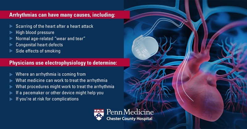 Arrhythmias